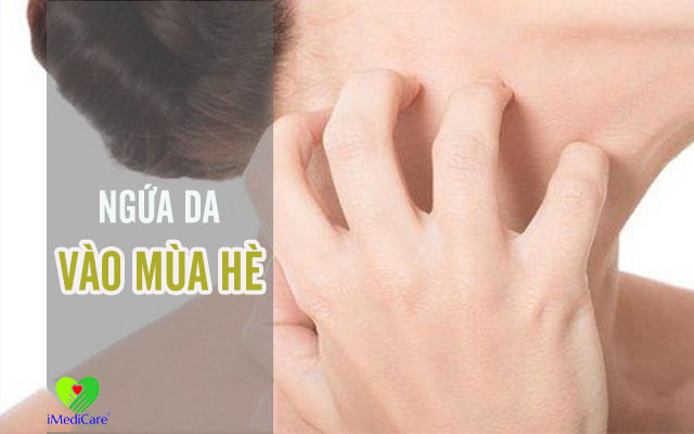 ngua-da-vao-mua-he