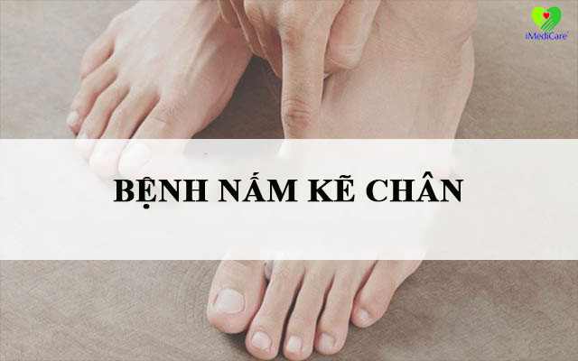 benh-nam-ke-chan